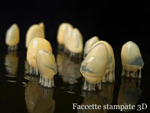 Faccette stampate 3D