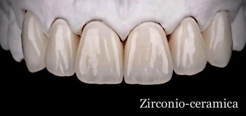 Zirconio-ceramica